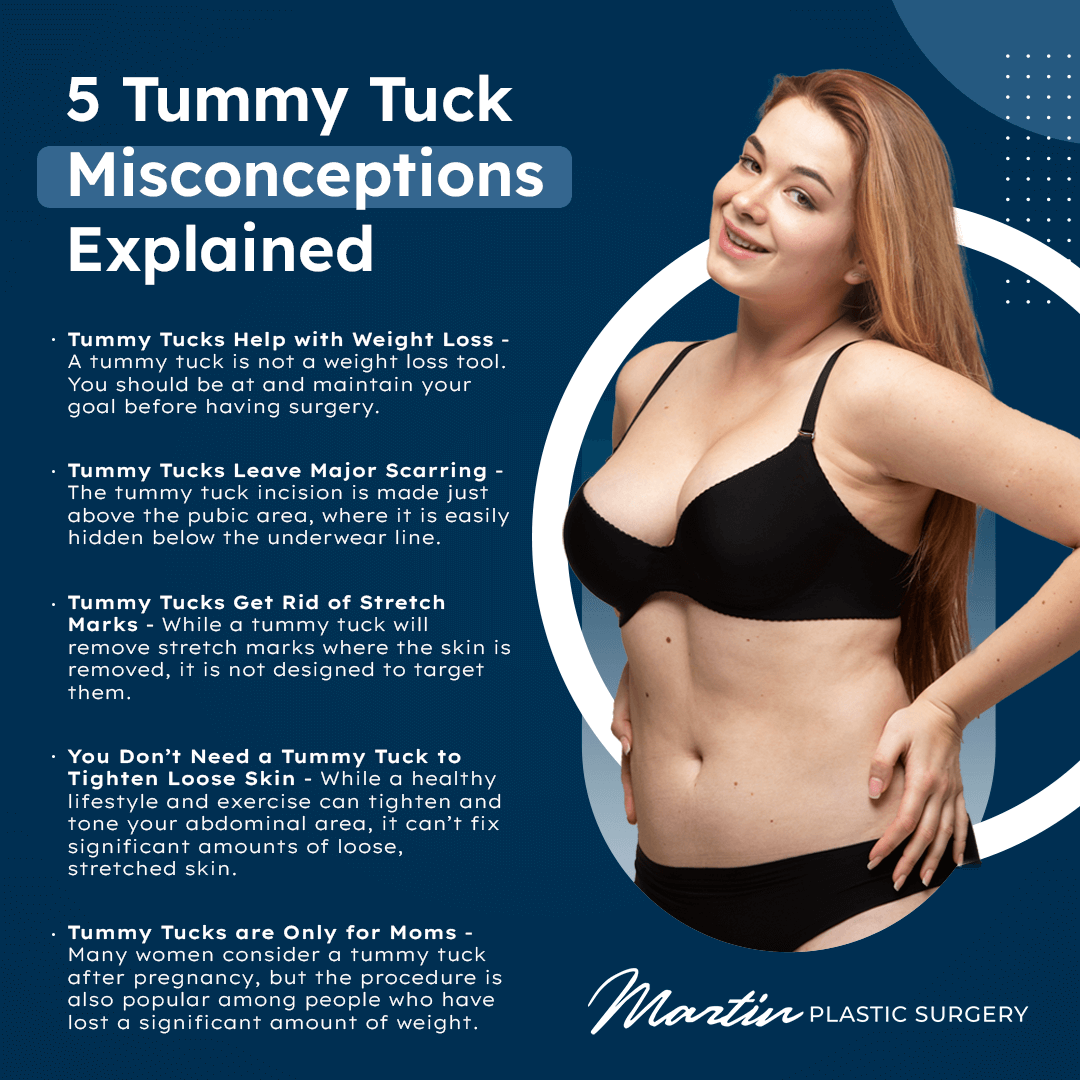 Tummy Tuck